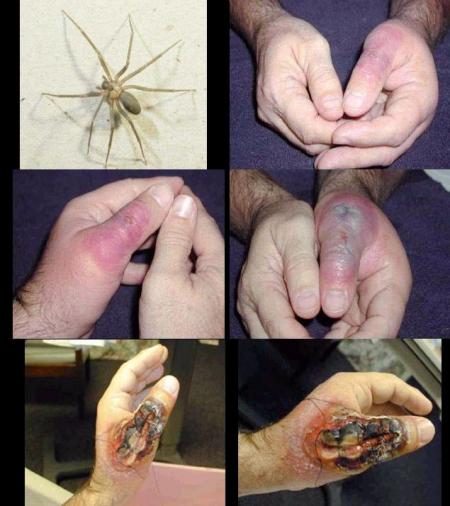 Araignée